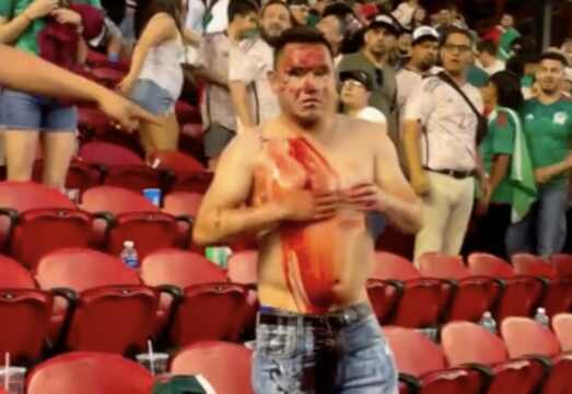 Mexico fan stabbed and bled