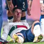 Ronaldo nasty injury
