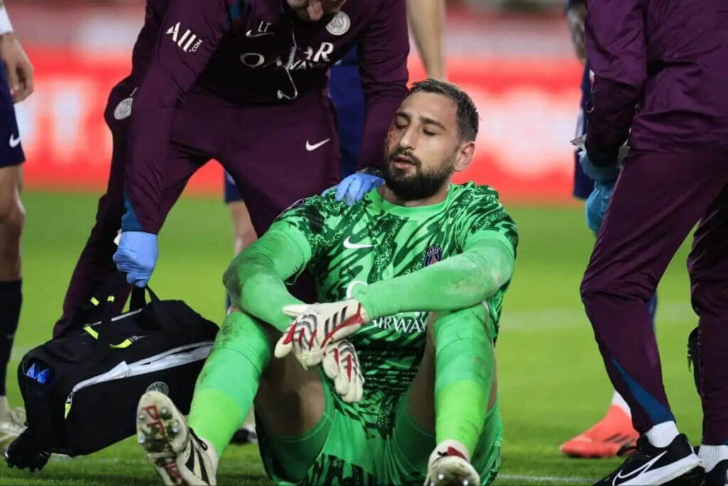 psg-keeper-donnarumma-suffers-horrific-facial-injury