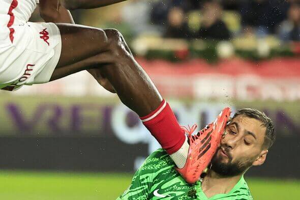 psg-keeper-donnarumma-suffers-horrific-facial-injury