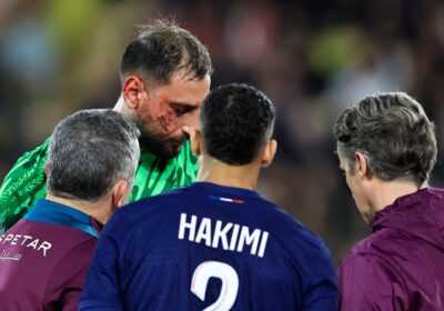 psg-keeper-donnarumma-suffers-horrific-facial-injury