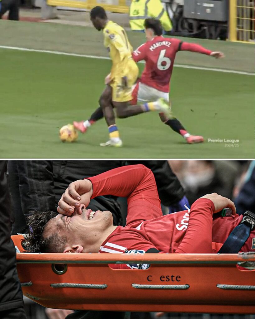 Lisandro Martinez picked up a serious injury as Man United defeated by Crystal Palace